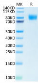 Biotinylated Recombinant Human CSF1R/M-CSF R/CD115 Protein (RP02337)