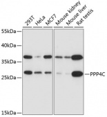 [One Step] PPP4C antibody Kit (RK05738)