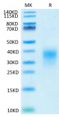 Recombinant Human ICOS/CD278(C136S, C137S) Protein (RP02381)