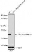 [KO Validated] CDKN2A/p16INK4a Rabbit mAb (A11651)