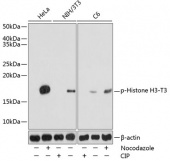 Phospho-Histone H3-T3 Antibody kit (RK05771)