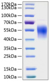 Recombinant Human IL-2RG/CD132 Protein (RP01205)