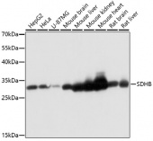 [One Step]SDHB Antibody Kit (RK05707)