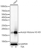 Acetyl-Histone H3-K9 Rabbit mAb (A22567)