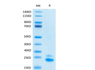 Biotinylated Recombinant Human TRAIL-R2/CD262 Protein (RP02085)