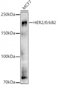 [KO Validated] HER2/ErbB2 Rabbit pAb (A21768)