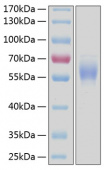 Recombinant Human DDR2/CD167b Protein (RP00115)