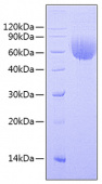 Recombinant Human IL-13RA1/CD213a1 Protein (RP00764)