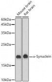 α-Synuclein Rabbit mAb (A20407)