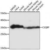 [One Step]C1QBP Antibody Kit (RK05628)
