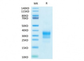 Biotinylated Recombinant Human IFN-gamma Protein (RP02383)
