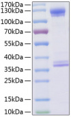 Recombinant Human C1qR/CD93 Protein (RP00164)