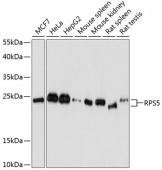 [One Step] RPS5 antibody Kit (RK05729)
