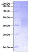 Recombinant Human IL-9 Protein (RP00869)