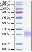 Recombinant Mouse CTLA-4/CD152 Protein (RP01326)