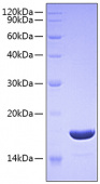 Recombinant Human TNFSF10/TRAIL/CD253 Protein (RP00822)