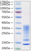 Recombinant Human IL-13 Protein (RP01320)