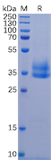Recombinant Human IL-2RB/CD122 Protein (RP02232)