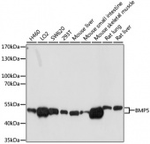 [One Step]BMP5 Antibody Kit (RK05627)