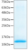 Recombinant Human BMP-2 Protein (RP02510)