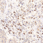 GB11888 Anti -XIAP Rabbit pAb Antibody