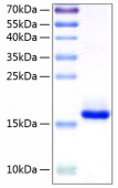 Рекомбинантный белок IL-10 человека (Recombinant Human IL-10 Protein)