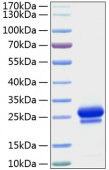 Recombinant Human VEGF-A/VEGF165 Protein (RP01150)