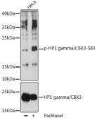 Phospho-CBX3-S83 Antibody kit (RK05782)