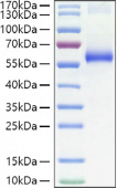 Recombinant Human TNFRSF1A/TNF-R1/CD120a Protein (RP01412)