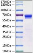 Recombinant Human JAM-2/VE-JAM/CD322 Protein (RP01184)