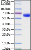 Active Recombinant Mouse TNFRSF1A/TNF-R1/CD120a Protein (RP01078)