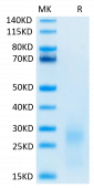Biotinylated Recombinant Human TSLP Protein (RP02092)