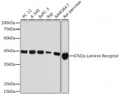 67kDa Laminin Receptor Rabbit mAb (A5968)