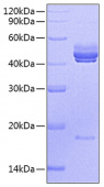 Recombinant Mouse IL-12B&IL-23A Protein (RP00763)