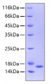 Recombinant Human IL36 gamma/IL-1F9 Protein (RP00035)