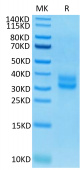 Biotinylated Recombinant Human TNFRSF9/4-1BB/CD137 Protein (RP02282)
