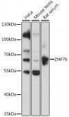 ZNF76 Rabbit pAb (A16627)