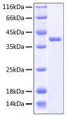 Recombinant Human IL-5RA/CD125 Protein (RP00411)
