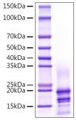 Recombinant Human IL-17A/CTLA-8 Protein (RP01534)