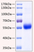 Active Recombinant Human TNFRSF11B/Osteoprotegerin Protein (RP00180)