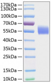 Recombinant Human IL-1R1/IL-1RT1/CD121a Protein (RP01036)