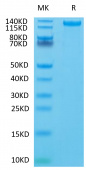 Recombinant Human CD163 Protein (RP02295)
