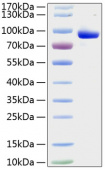 Recombinant Human FLT-3/FLK-2 Protein (RP01138)