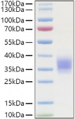 Recombinant Human TNFRSF1A/TNF-R1/CD120a Protein (RP01347)