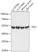 ZIC1 Rabbit pAb (A17547)