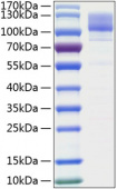 Recombinant Human ITGB1/CD29 Protein (RP00232)
