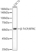β-TrCP/BTRC Rabbit mAb (A21951)