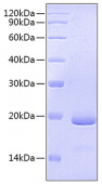 Recombinant Human IL-11 Protein (RP00474)