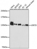 [One Step]USP25 Antibody Kit (RK05720)