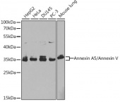 [KO Validated] Annexin A5/Annexin V Rabbit pAb (A1728)